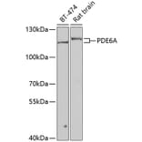 Western Blot - Anti-PDE6 alpha Antibody (A15972) - Antibodies.com