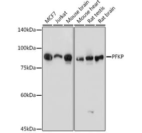 Western Blot - Anti-PFKP Antibody (A15973) - Antibodies.com