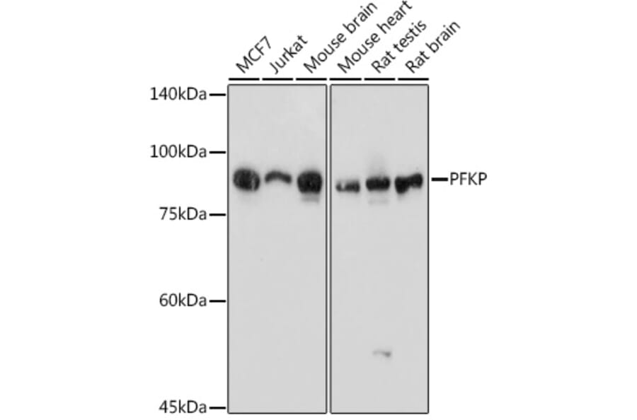 Western Blot - Anti-PFKP Antibody (A15973) - Antibodies.com