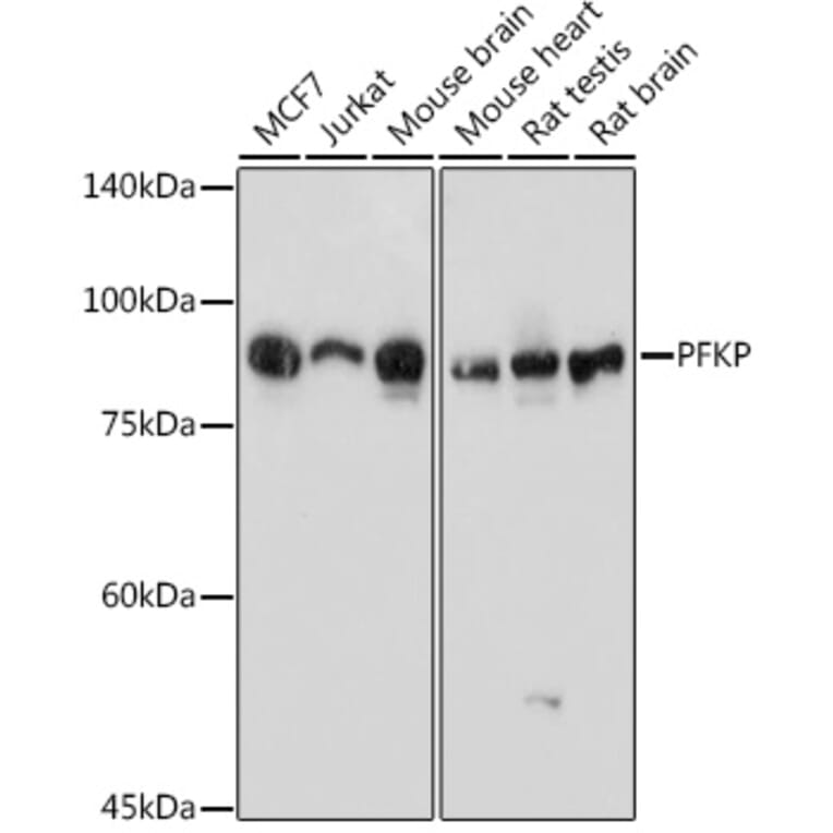 Western Blot - Anti-PFKP Antibody (A15973) - Antibodies.com