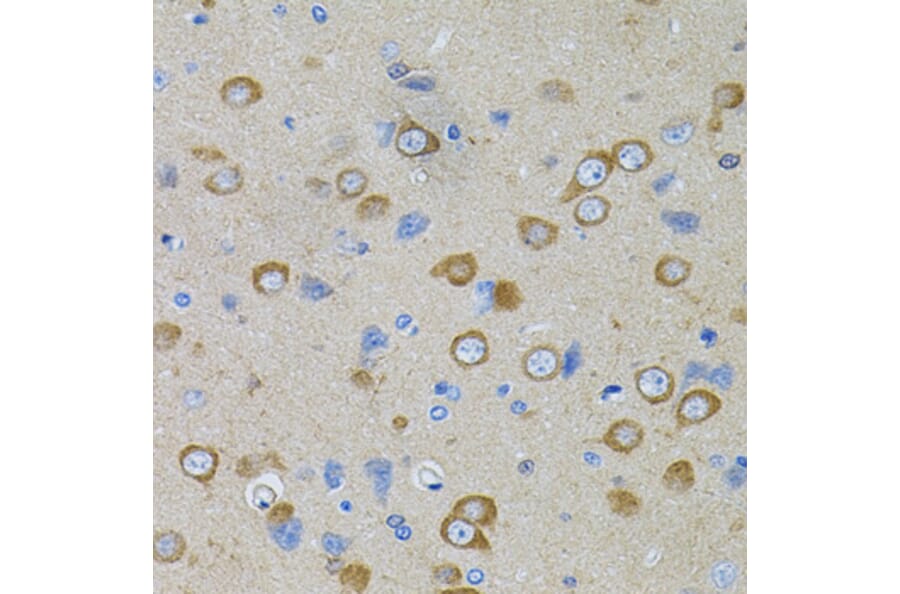 Immunohistochemistry - Anti-PFKP Antibody (A15973) - Antibodies.com