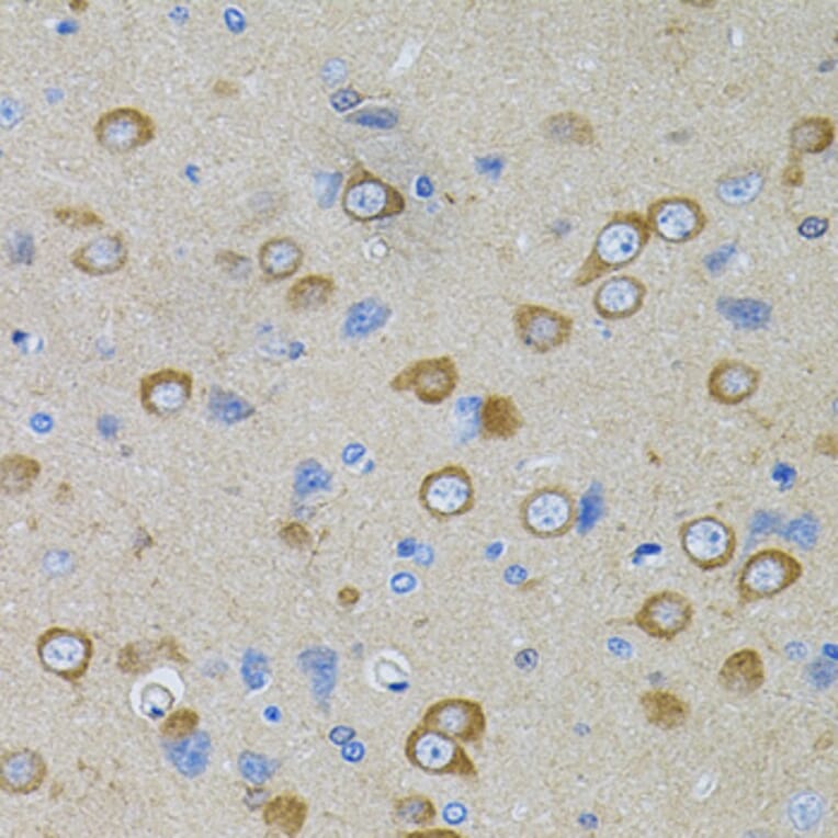 Immunohistochemistry - Anti-PFKP Antibody (A15973) - Antibodies.com