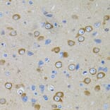 Immunohistochemistry - Anti-PFKP Antibody (A15973) - Antibodies.com