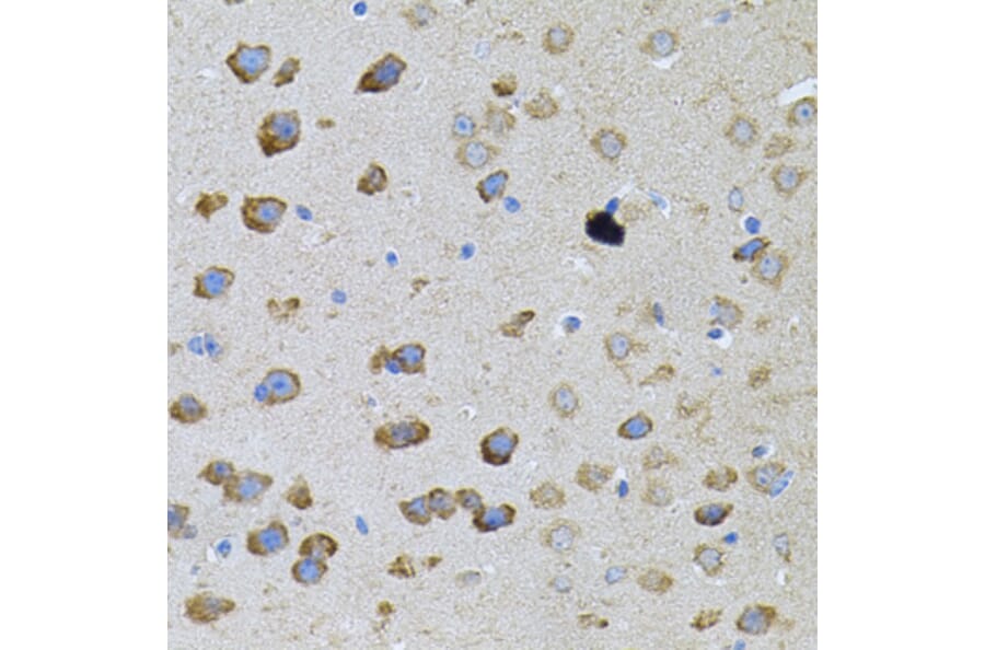 Immunohistochemistry - Anti-PFKP Antibody (A15973) - Antibodies.com