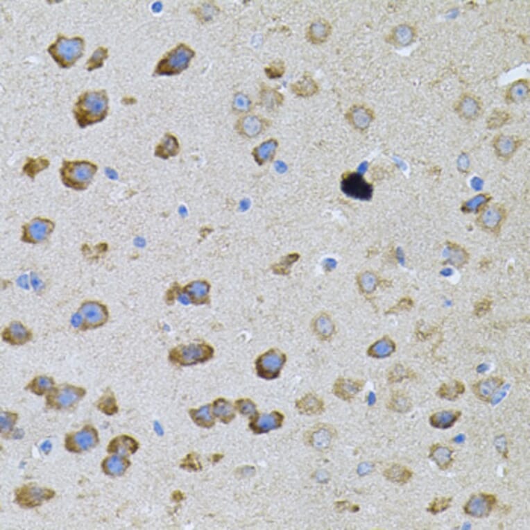Immunohistochemistry - Anti-PFKP Antibody (A15973) - Antibodies.com