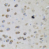 Immunohistochemistry - Anti-PFKP Antibody (A15973) - Antibodies.com