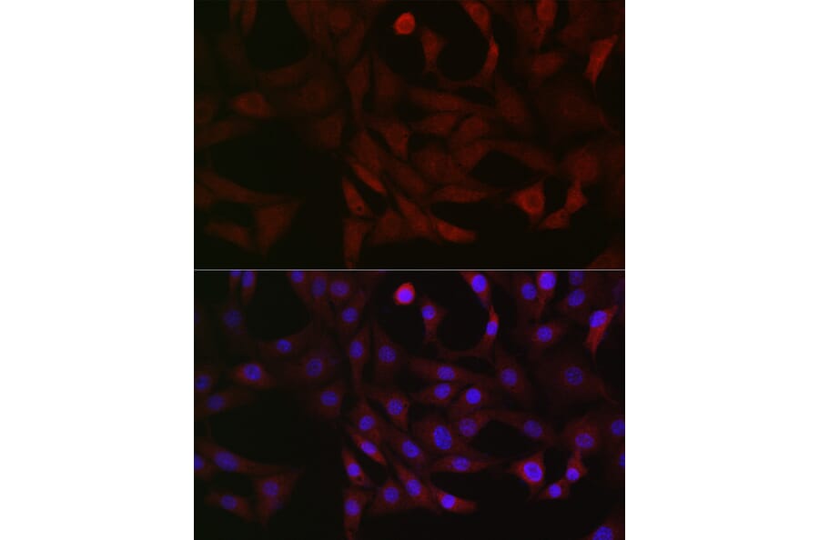 Immunofluorescence - Anti-PFKP Antibody (A15973) - Antibodies.com