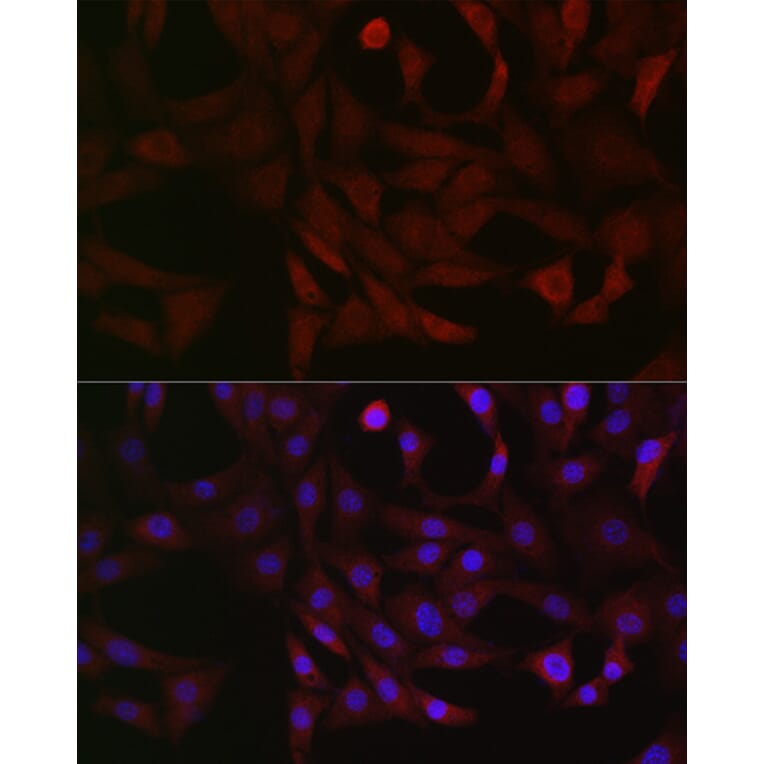Immunofluorescence - Anti-PFKP Antibody (A15973) - Antibodies.com