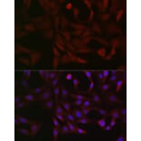 Immunofluorescence - Anti-PFKP Antibody (A15973) - Antibodies.com