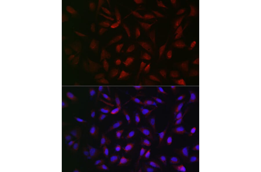 Immunofluorescence - Anti-PFKP Antibody (A15973) - Antibodies.com