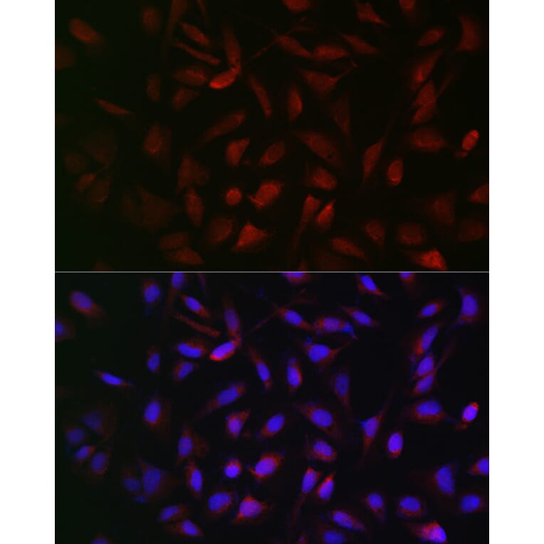 Immunofluorescence - Anti-PFKP Antibody (A15973) - Antibodies.com