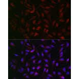 Immunofluorescence - Anti-PFKP Antibody (A15973) - Antibodies.com