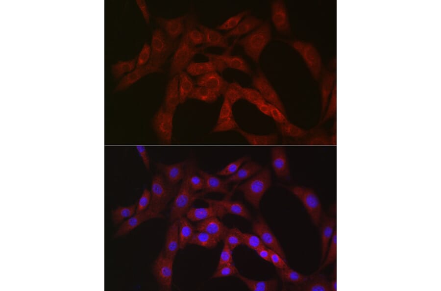 Immunofluorescence - Anti-PFKP Antibody (A15973) - Antibodies.com