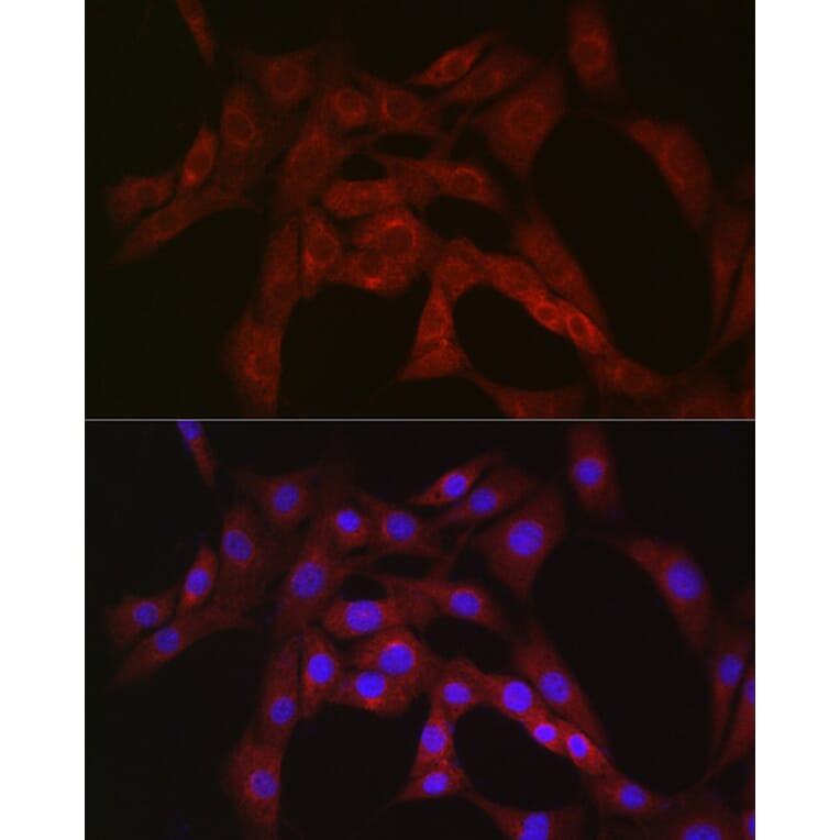 Immunofluorescence - Anti-PFKP Antibody (A15973) - Antibodies.com