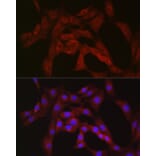 Immunofluorescence - Anti-PFKP Antibody (A15973) - Antibodies.com
