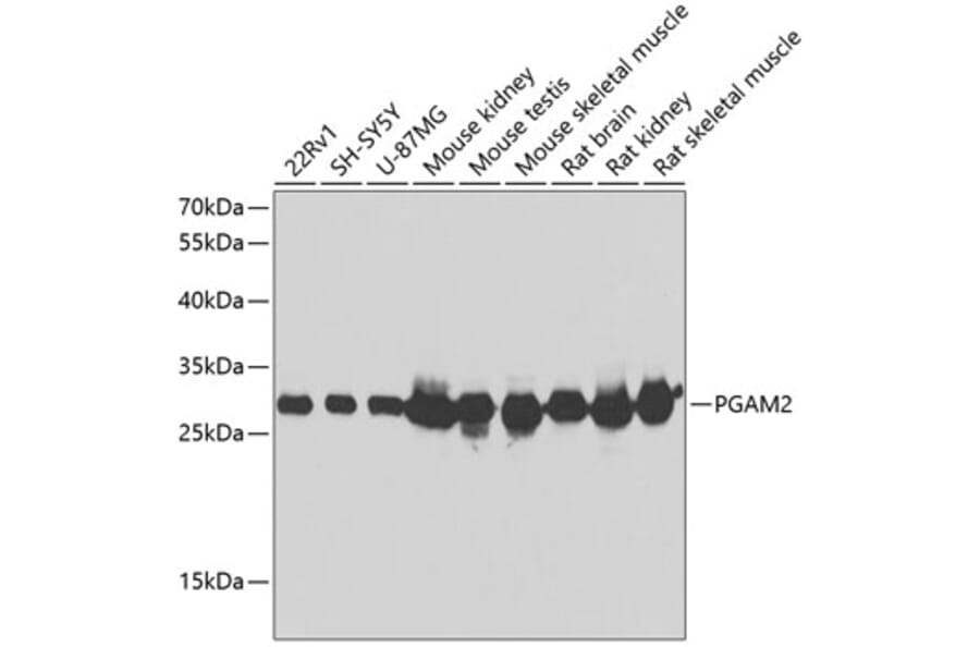 Western Blot - Anti-PGAM2 Antibody (A15974) - Antibodies.com