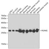 Western Blot - Anti-PGAM2 Antibody (A15974) - Antibodies.com