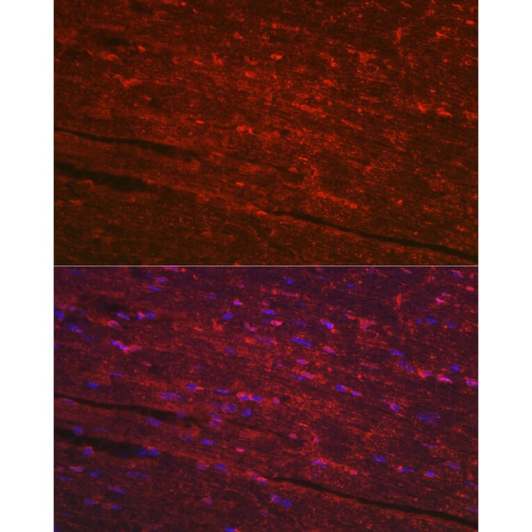 Immunofluorescence - Anti-PGAM2 Antibody (A15974) - Antibodies.com