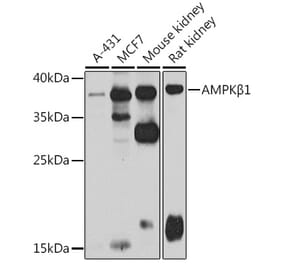 Western Blot - Anti-AMPK beta 1 Antibody (A15977) - Antibodies.com