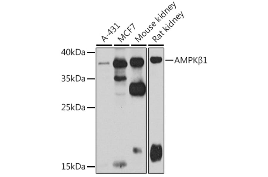 Western Blot - Anti-AMPK beta 1 Antibody (A15977) - Antibodies.com