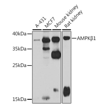 Western Blot - Anti-AMPK beta 1 Antibody (A15977) - Antibodies.com