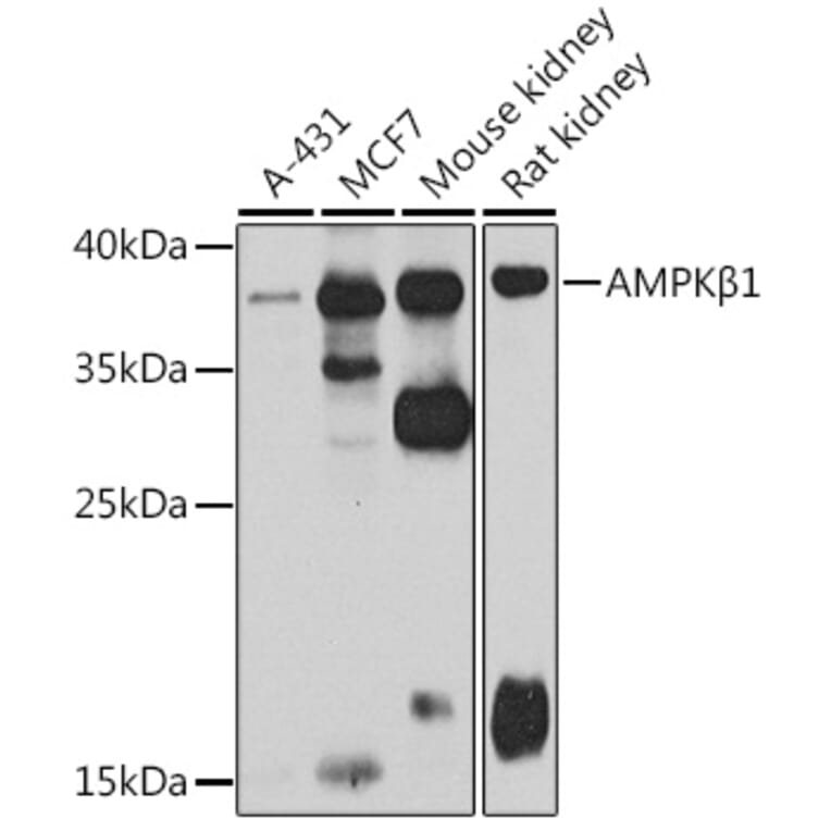 Western Blot - Anti-AMPK beta 1 Antibody (A15977) - Antibodies.com