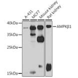 Western Blot - Anti-AMPK beta 1 Antibody (A15977) - Antibodies.com