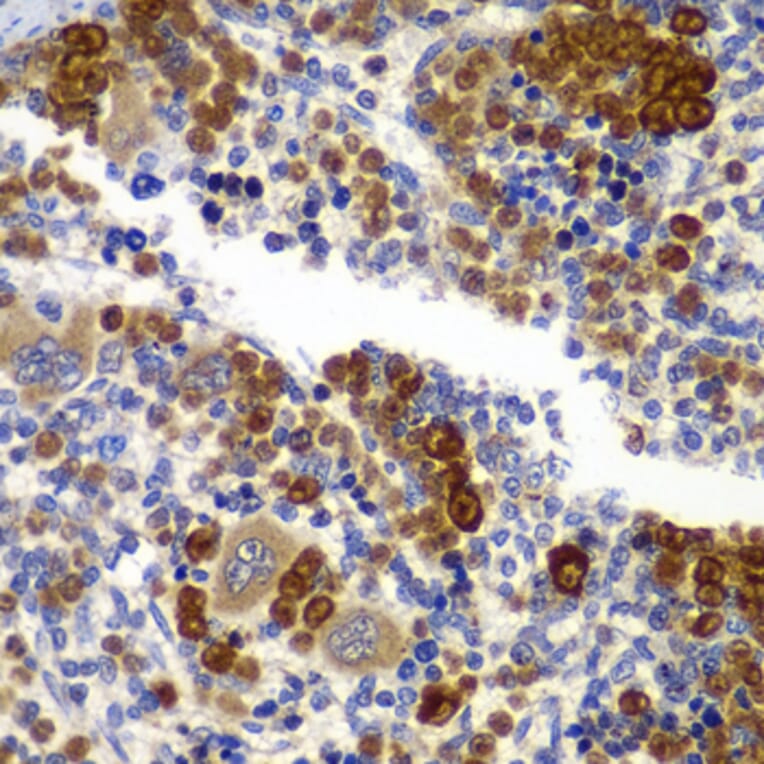 Immunohistochemistry - Anti-AMPK beta 1 Antibody (A15977) - Antibodies.com