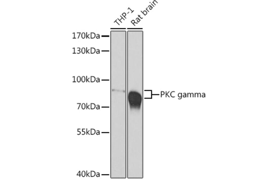 Western Blot - Anti-PKC gamma Antibody (A15978) - Antibodies.com