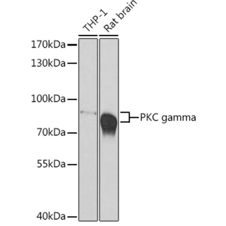 Western Blot - Anti-PKC gamma Antibody (A15978) - Antibodies.com
