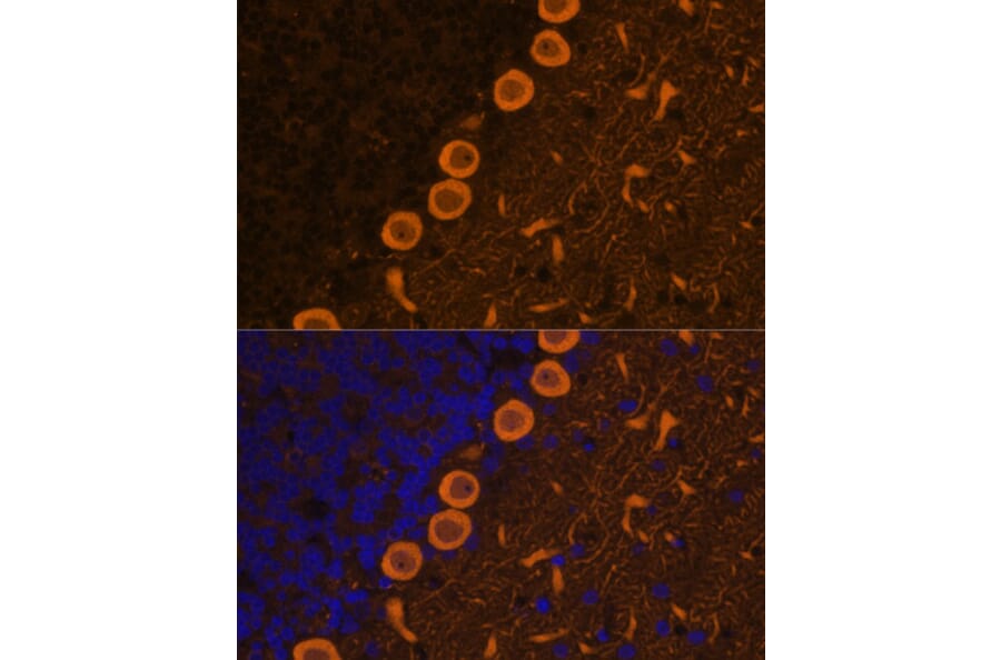Immunofluorescence - Anti-PKC gamma Antibody (A15978) - Antibodies.com