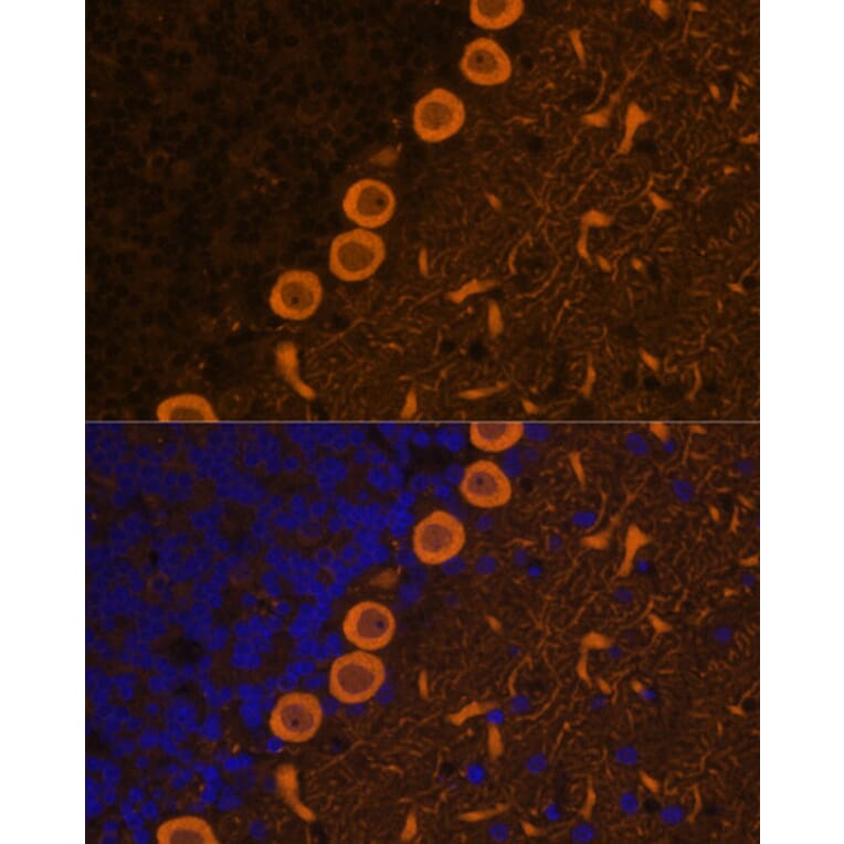 Immunofluorescence - Anti-PKC gamma Antibody (A15978) - Antibodies.com
