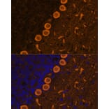 Immunofluorescence - Anti-PKC gamma Antibody (A15978) - Antibodies.com