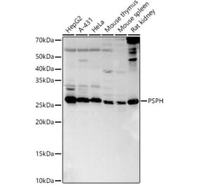 Western Blot - Anti-PSPH Antibody (A15979) - Antibodies.com