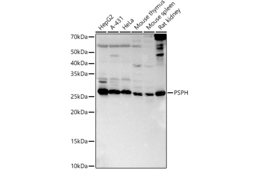 Western Blot - Anti-PSPH Antibody (A15979) - Antibodies.com