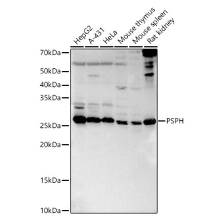 Western Blot - Anti-PSPH Antibody (A15979) - Antibodies.com