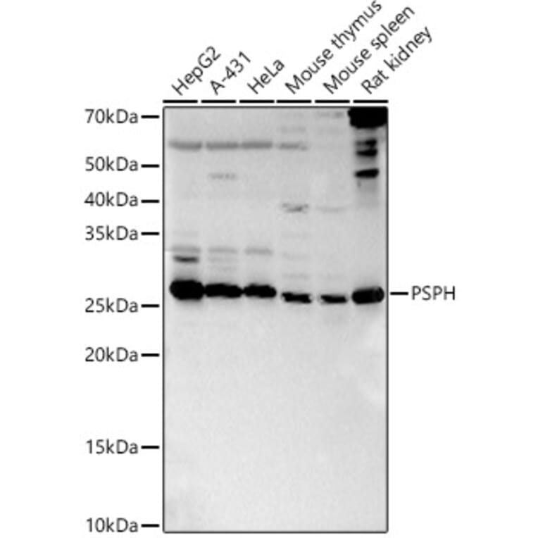 Western Blot - Anti-PSPH Antibody (A15979) - Antibodies.com