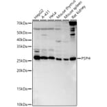 Western Blot - Anti-PSPH Antibody (A15979) - Antibodies.com