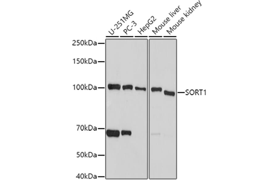 Western Blot - Anti-Sortilin/NT3 Antibody (A15980) - Antibodies.com