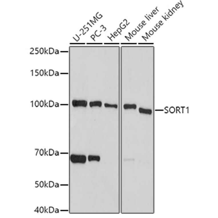 Western Blot - Anti-Sortilin/NT3 Antibody (A15980) - Antibodies.com