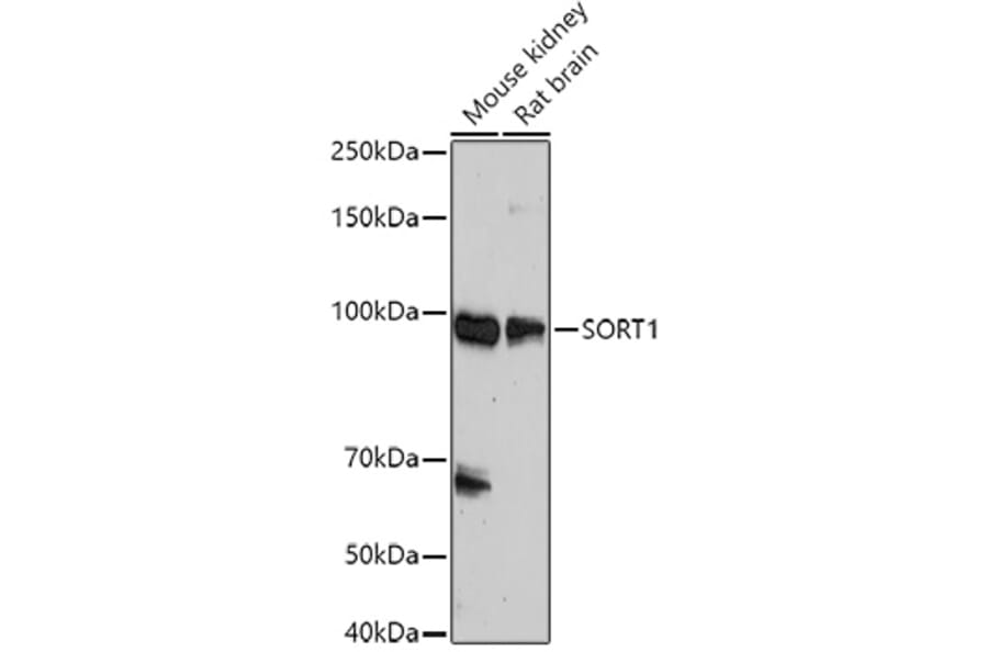Western Blot - Anti-Sortilin/NT3 Antibody (A15980) - Antibodies.com