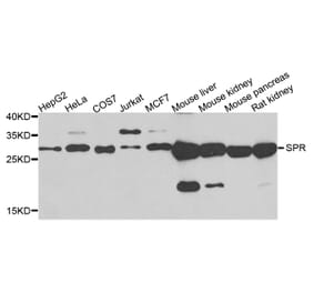Western Blot - Anti-SPR Antibody (A7928) - Antibodies.com
