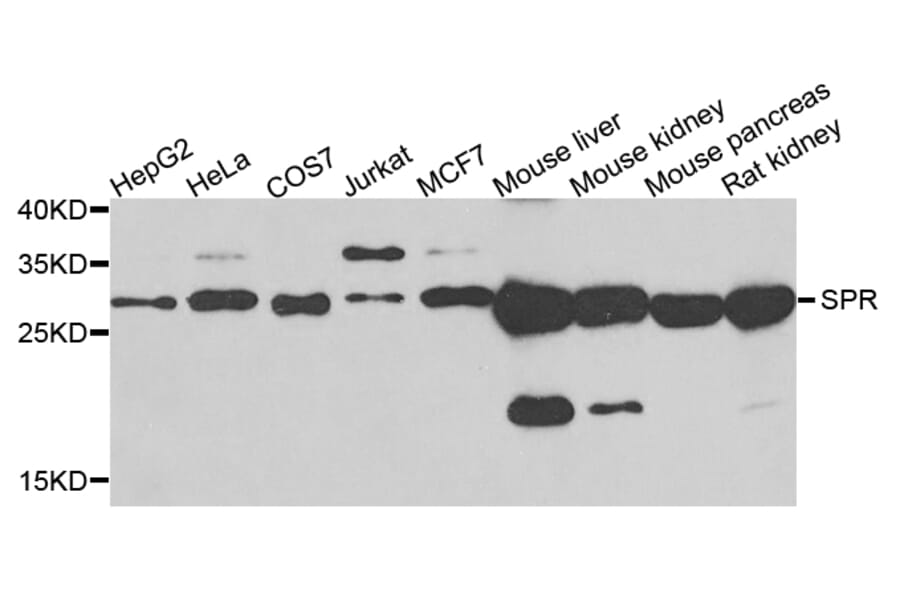 Western Blot - Anti-SPR Antibody (A7928) - Antibodies.com