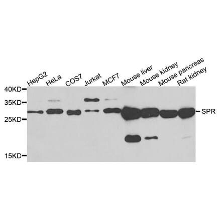 Western Blot - Anti-SPR Antibody (A7928) - Antibodies.com