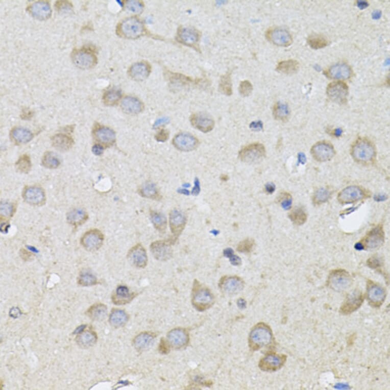 Immunohistochemistry - Anti-SPR Antibody (A7928) - Antibodies.com
