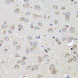 Immunohistochemistry - Anti-SPR Antibody (A7928) - Antibodies.com