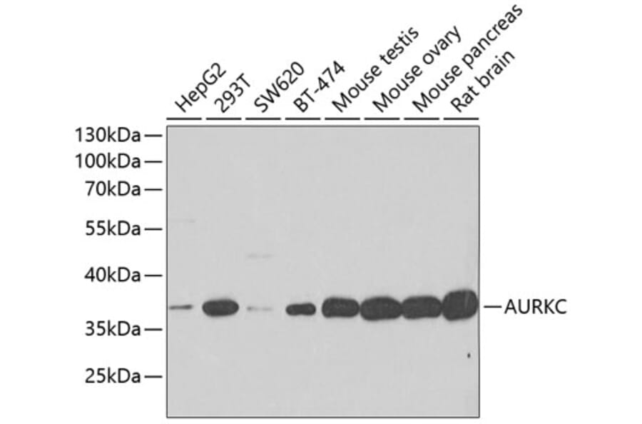 Western Blot - Anti-IPL-1/STK13/Aurora C Antibody (A15982) - Antibodies.com