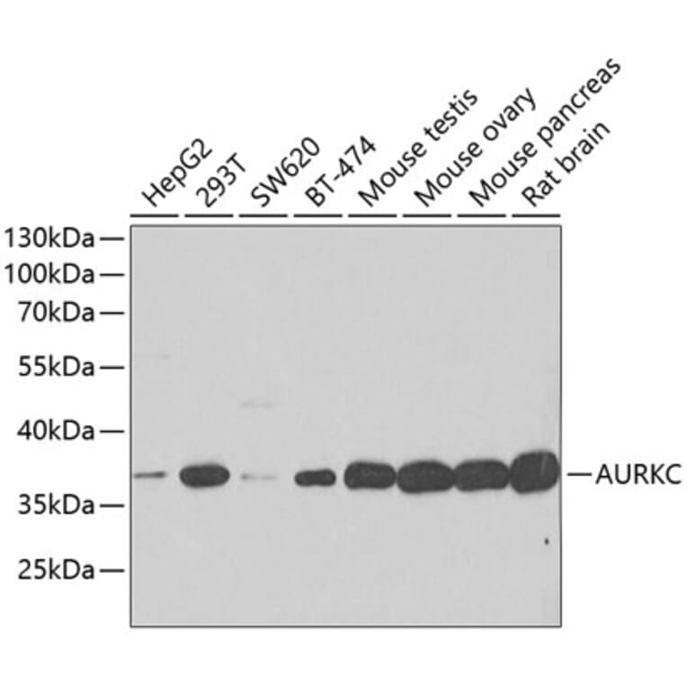 Western Blot - Anti-IPL-1/STK13/Aurora C Antibody (A15982) - Antibodies.com