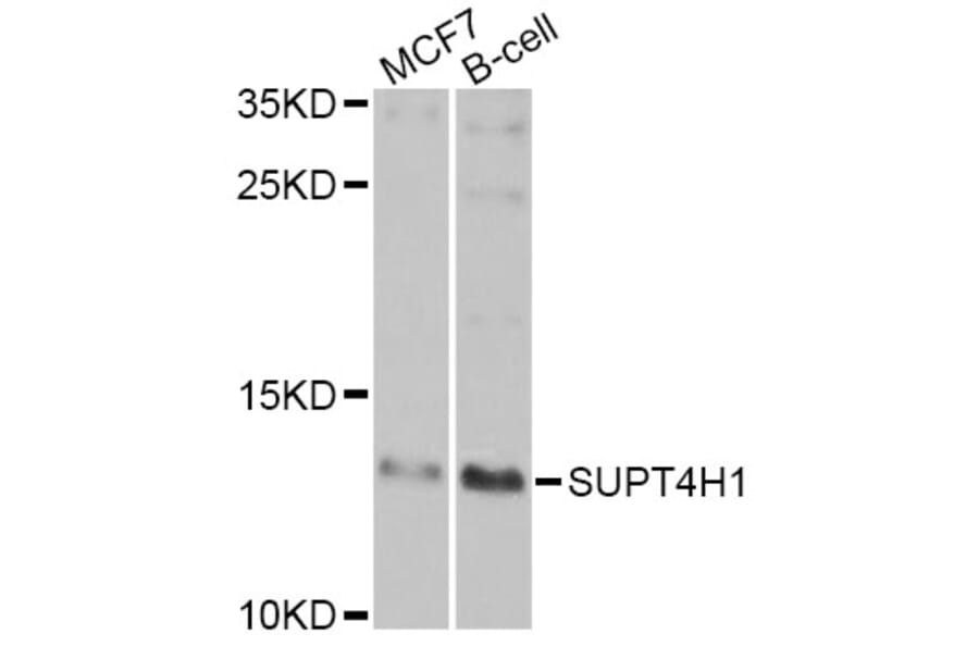 Western Blot - Anti-SUPT4H1 Antibody (A7933) - Antibodies.com