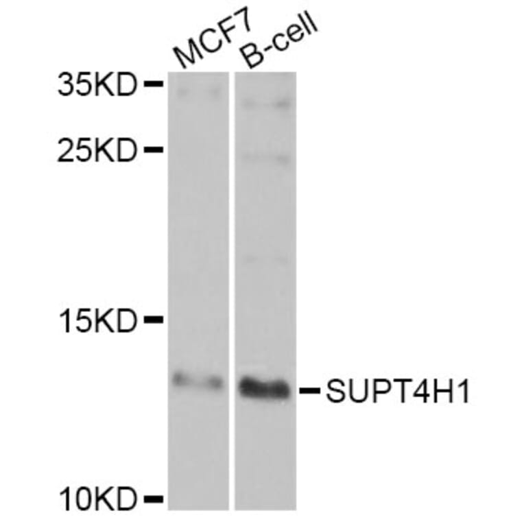 Western Blot - Anti-SUPT4H1 Antibody (A7933) - Antibodies.com